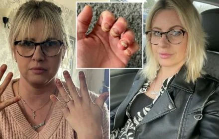 I've had gel manicures my whole life but now I can barely use my hands and my nails have peeled off