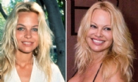 Navigating the Complex World of Celebrity Cosmetic Surgery: Insights from Hollywood Plastic Surgeon Dr. Motykie
