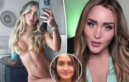 Woman's Transformation: From Self-Perceived Ugliness to Confidence with Cosmetic Enhancements